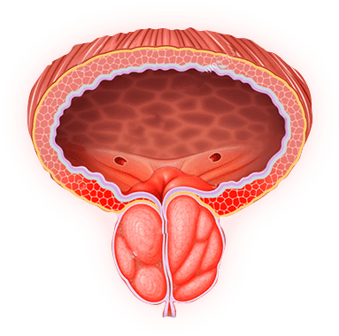 Просталис, Adenofrin, при проблем с простата